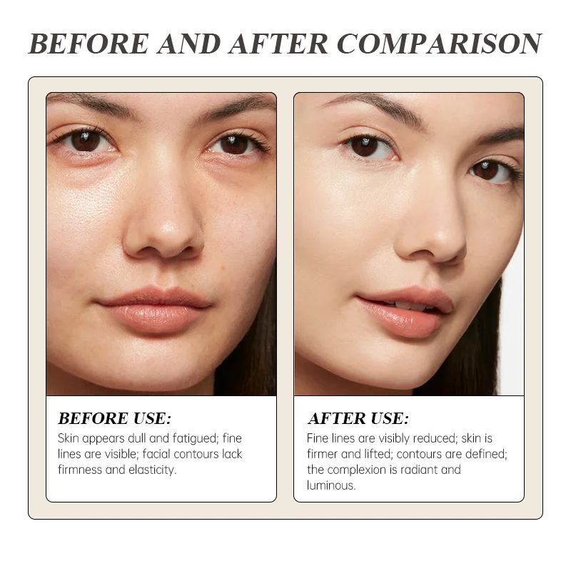 Side-by-side comparison showing a woman's face before and after skincare use. Skin before is dull with visible fine lines; after shows smoother, radiant, and firmer skin.